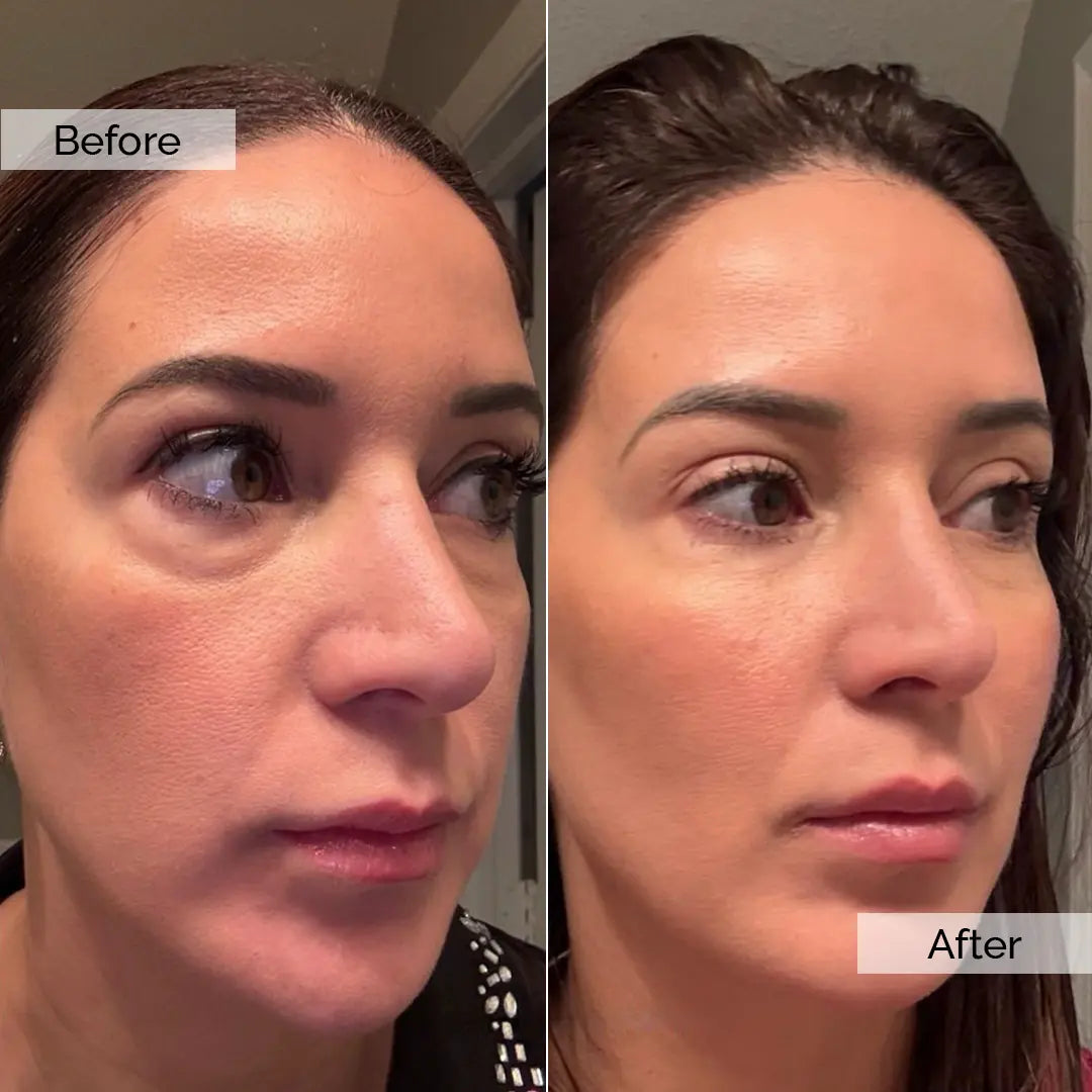 Before/After – Amanda